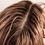 برای کاهش چربی مو از چه ماسکی استفاده کنیم؟